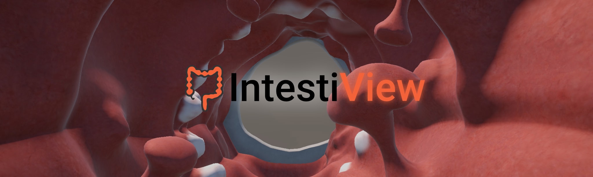 IntestiView