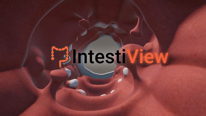 IntestiView