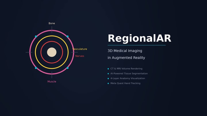 RegionalAR